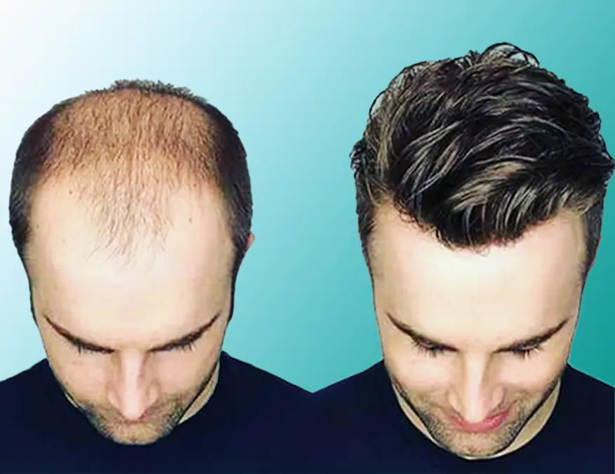 483052972_slider_Hair Bonding.webp